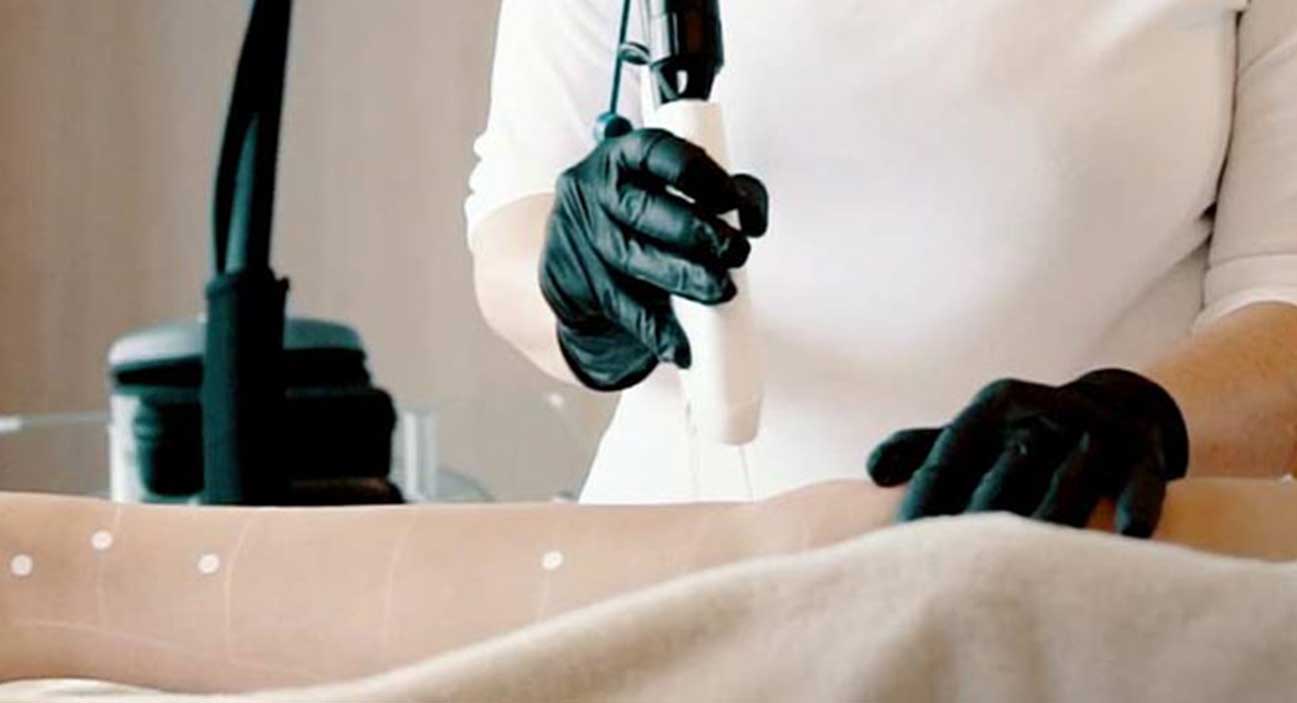  Hair removal (half legs: upper OR lower legs)