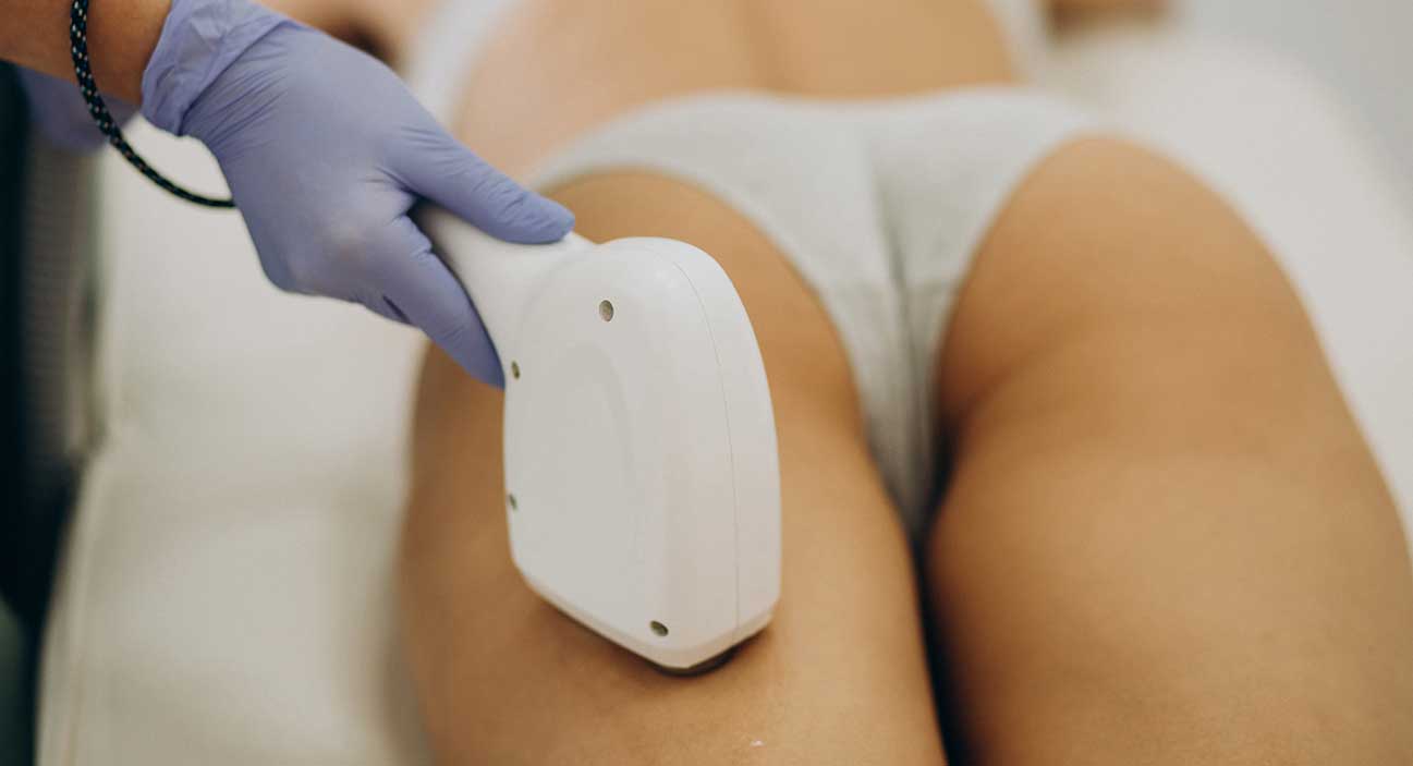Hair removal (buttocks)