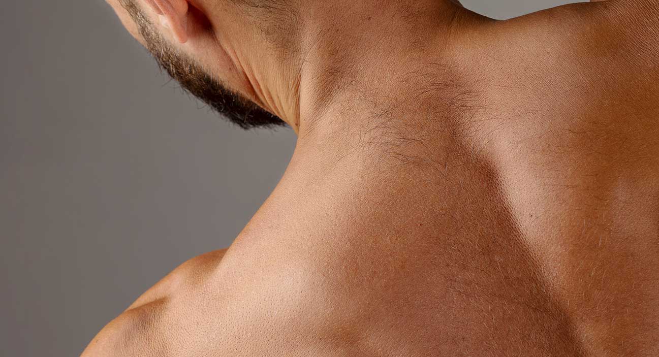 Haarentfernung (Rücken Männer + Schulter) 