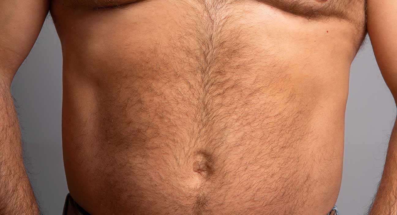 Hair removal belly