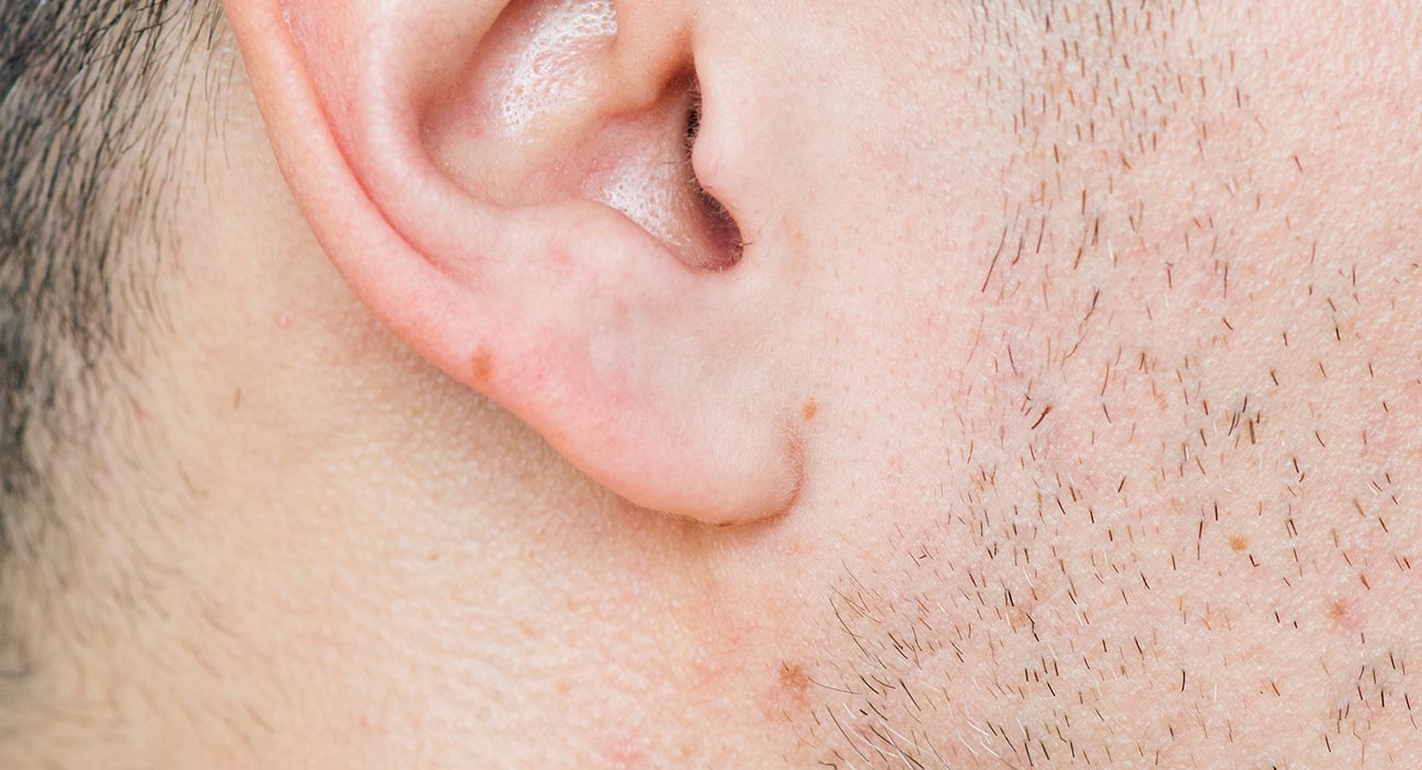 Ear/earlobe volume building