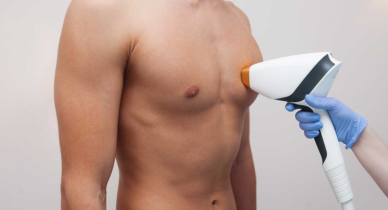  Hair removal (chest men + stomach)