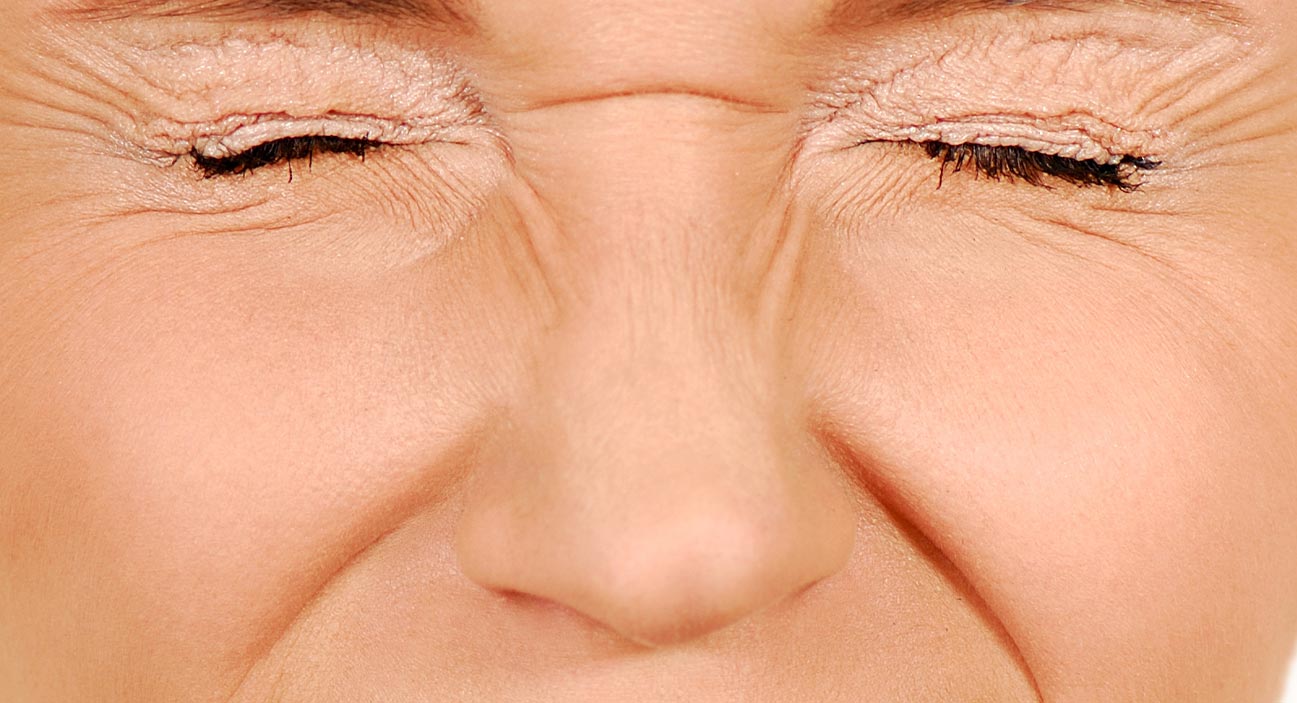 Botulinum toxin bunny lines